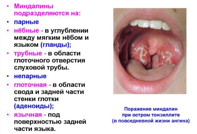  Fr dc ru