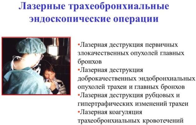 Лазерные трахеобронхиальные эндоскопические