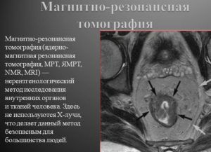 МРТ для диагностики паралича глотки