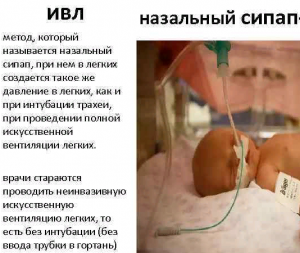 СиПАП