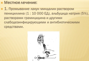 Промывание лакун