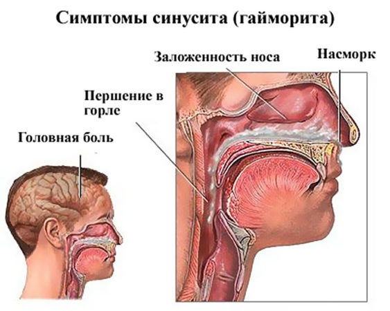 Основные признаки