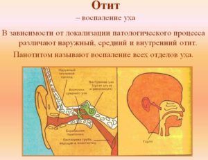 Отит
