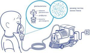 Схема работы небулайзера