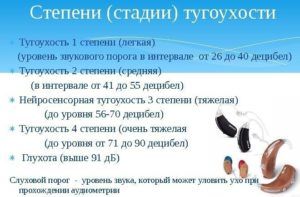 Степени тугоухости