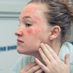 Насколько эффективно применение Гепариновой мази от морщин