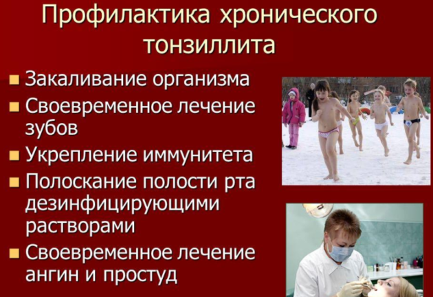 Профилактика хронического тонзиллита