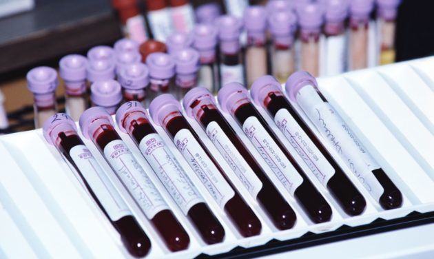 Анализ на инфекции