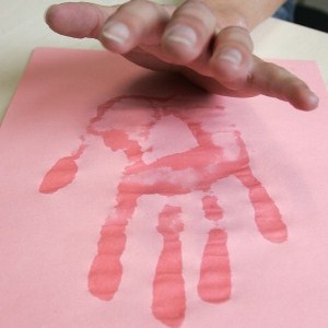 Лечение потливости рук и ног аппаратными, хирургическими и народными методами