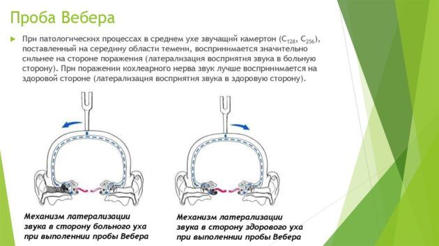 Проба Вебера