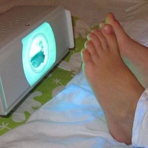 Особенности течения и методы лечения хронической экземы