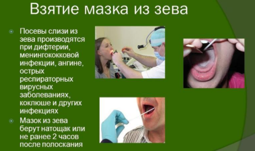 Мазок из горла
