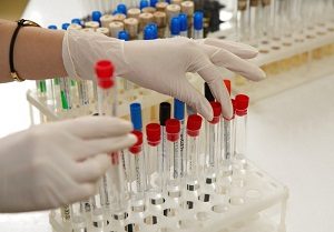 лютеинизирующий гормон повышен у женщин