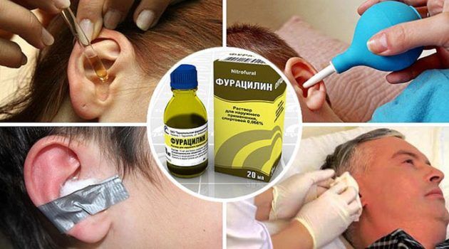Раствор фурацилина для уха