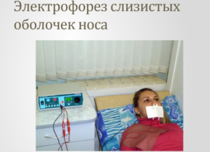Электрофорез при рините