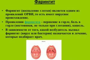 Аллергического фарингита