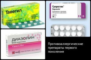 Антигистаминные препараты при аллергии