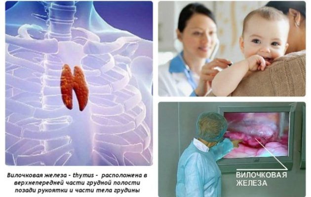 Расположение вилочковой железы