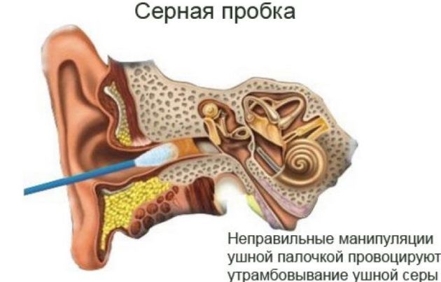 Серная пробка
