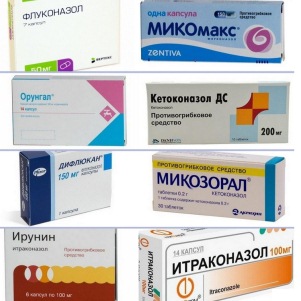 Применение таблеток Кетоконазол для лечения грибка