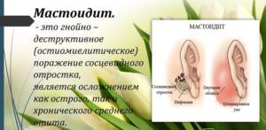 Мастоидит