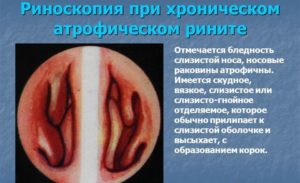 Риноскопия