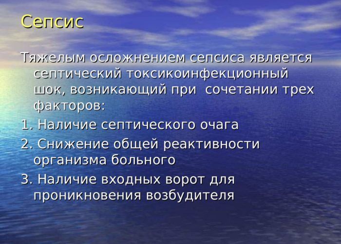 Сепсис