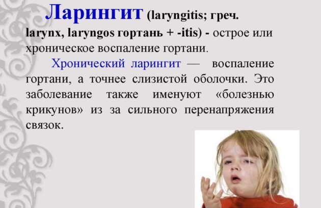 Ларингит