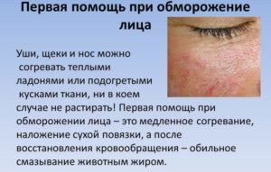 Обморожение лица