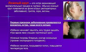 Ложный круп
