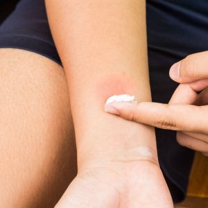Целестодерм-В: в каких случаях назначают и как использовать