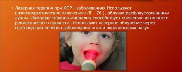 Лазеротерапия