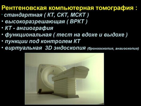 Компьютерная томография
