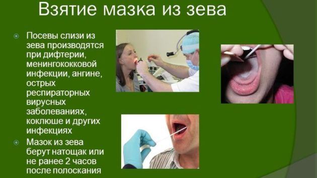 Взятие мазка