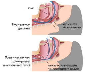 Анатомия храпа
