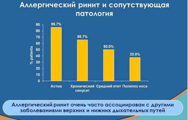 Ринит