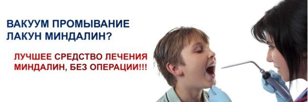 Промывание миндалин