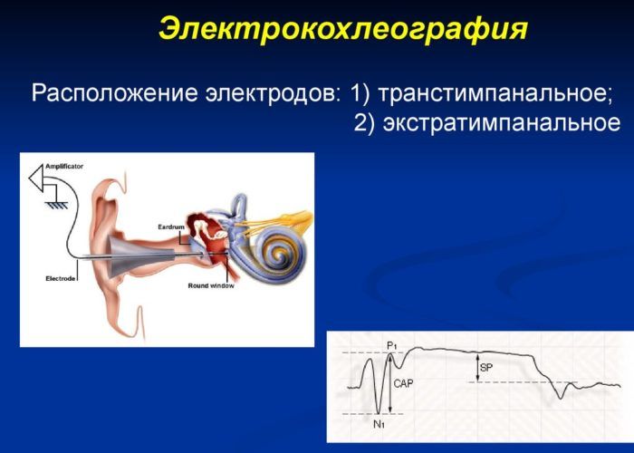 Электрокохлеография