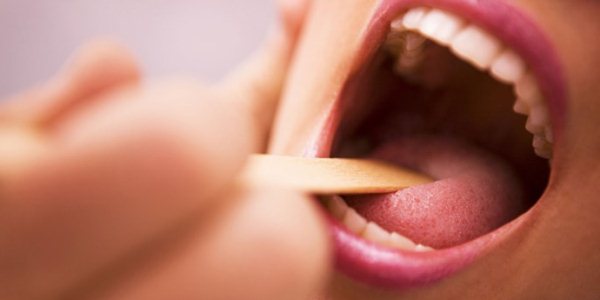 Что делать при ожоге языка: советы специалистов