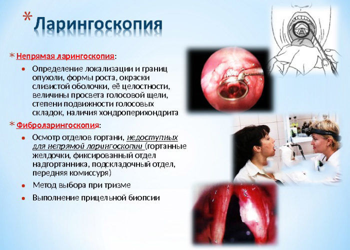 Ларингоскопия горла