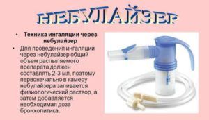 Техника ингаляции через небулайзер