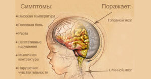 Симптомы и поражения при менингите