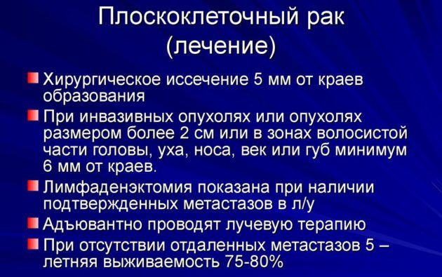 Плоскоклеточный рак
