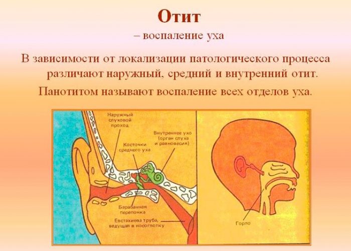 Отит пловцов Отит пловцов