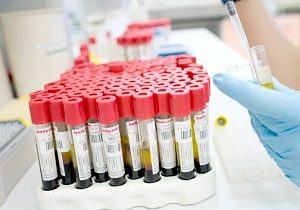 дигидротестостерон повышен у женщин