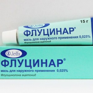 Особенности возникновения и правила лечения острой крапивницы