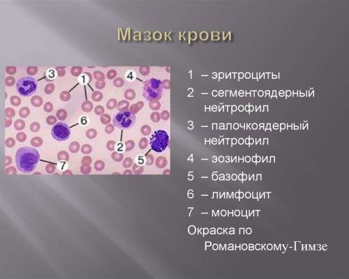 Мазок плазмы крови