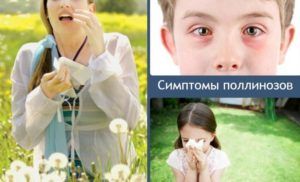 Симптомы поллинозов