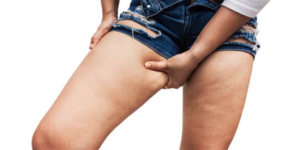 Как бороться с целлюлитом на ногах