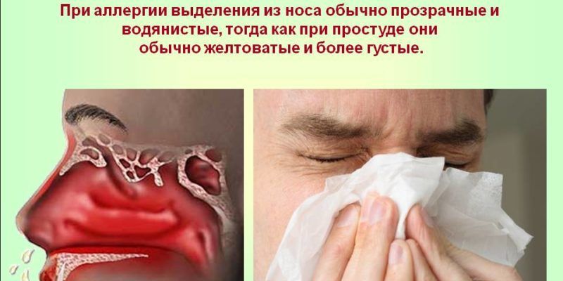 Ринорея